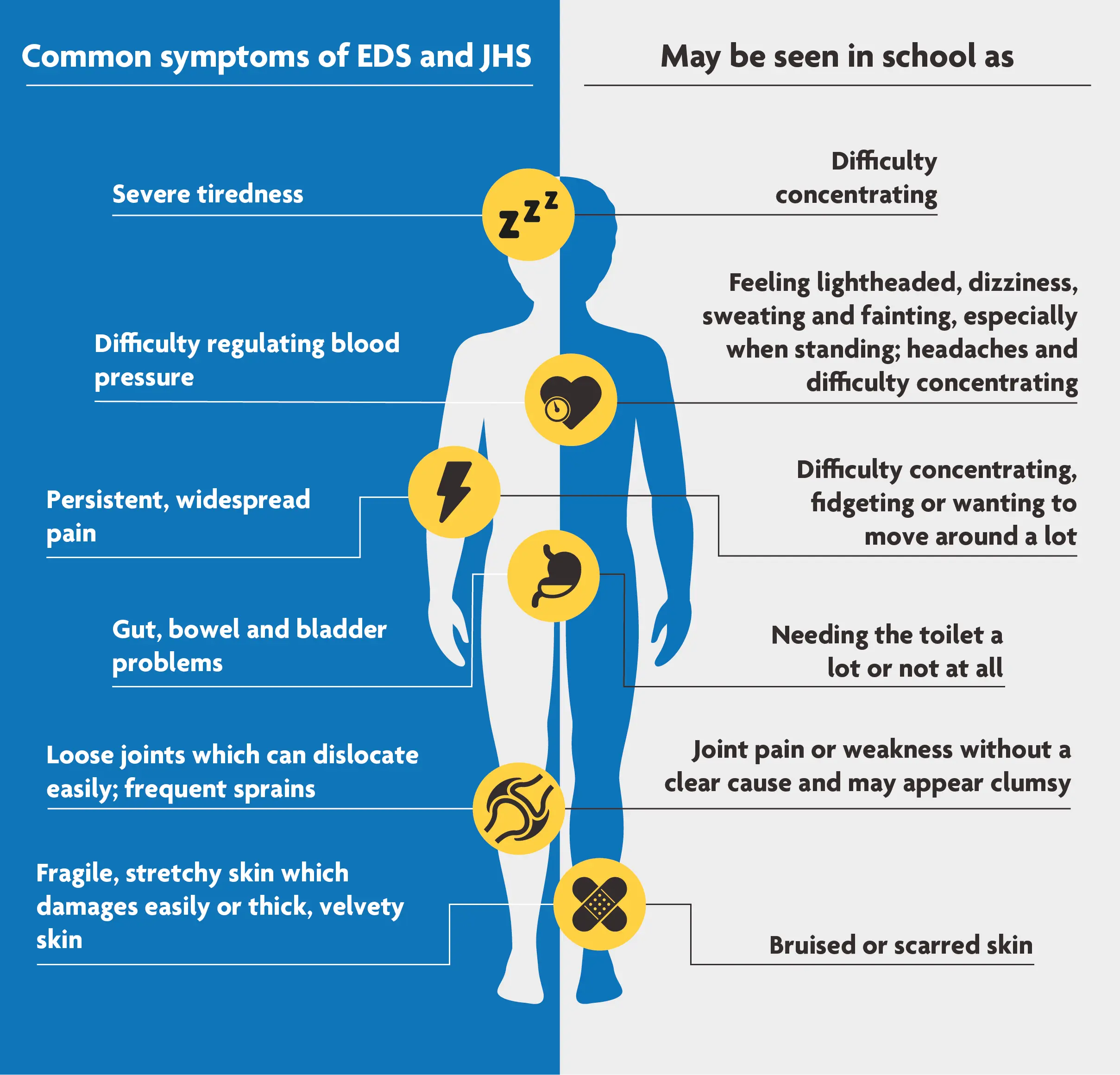 Ehlers-Danlos Syndrome (EDS) &#8211; symptoms and treatment of the disease