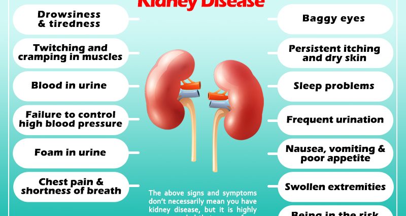 Eight symptoms that could be a sign of a kidney problem