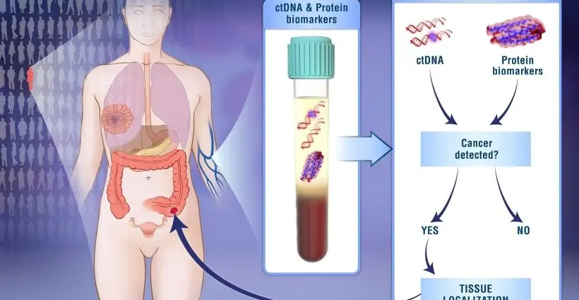 eight-types-of-cancer-will-be-detected-with-a-simple-blood-test