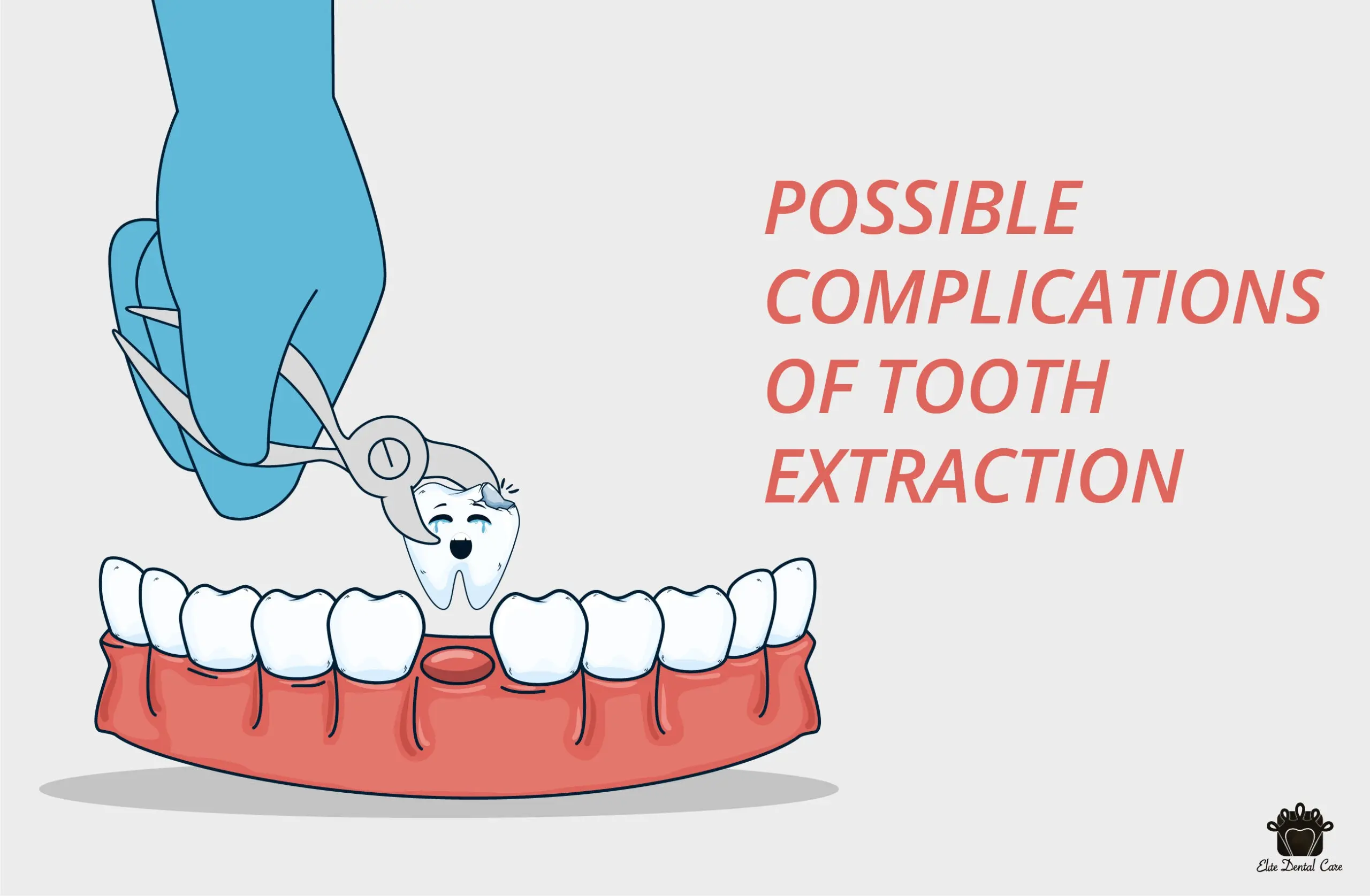 Eights extraction &#8211; preparations for the treatment. Possible complications after removing eights