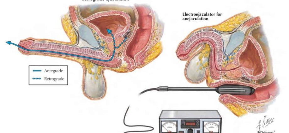 Ejaculation &#8211; how and when does it occur? Ejaculation disorders