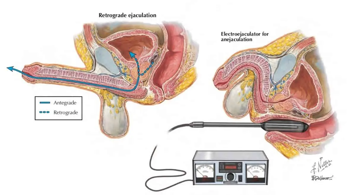 Ejaculation &#8211; how and when does it occur? Ejaculation disorders