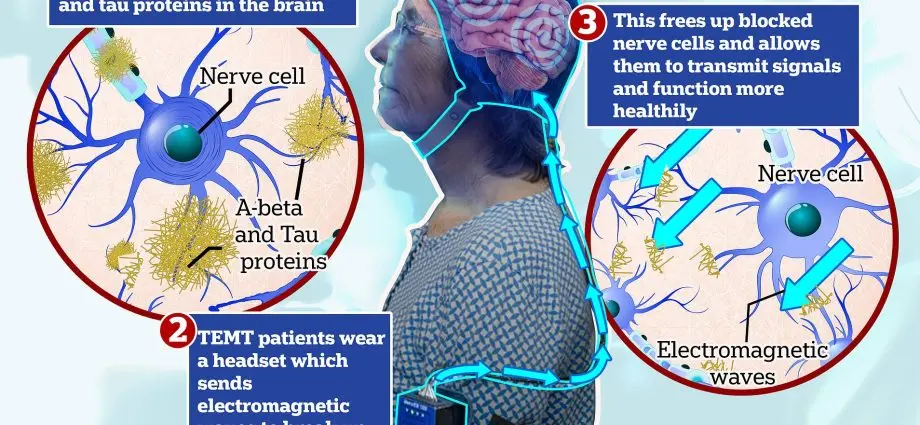 Electromagnetic waves can reverse Alzheimer&#8217;s disease