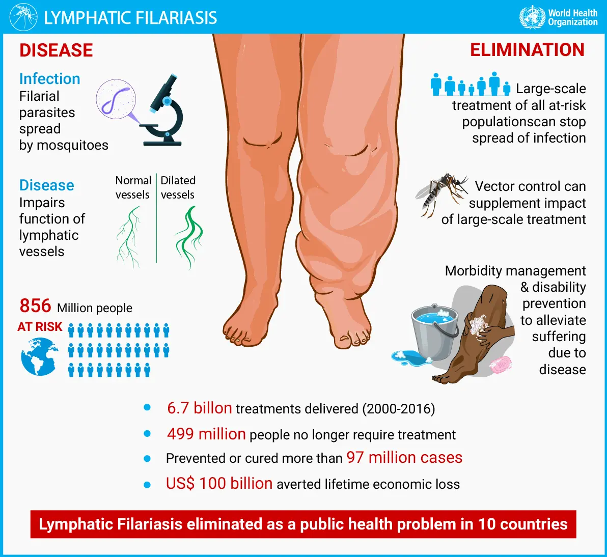 Elephantiasis &#8211; causes, symptoms, treatment