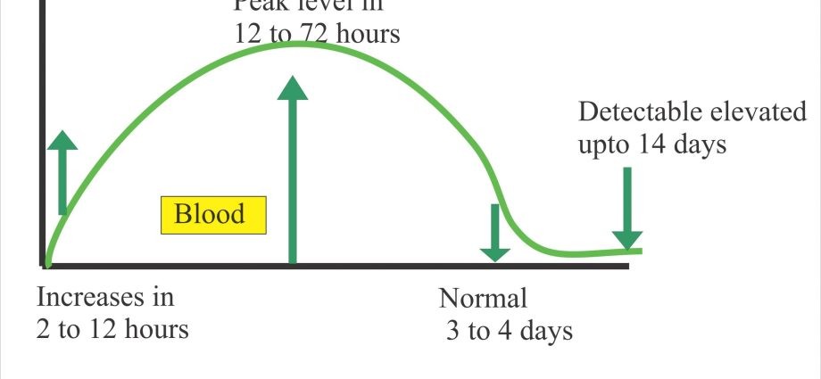 Elevated lipase and pancreatitis