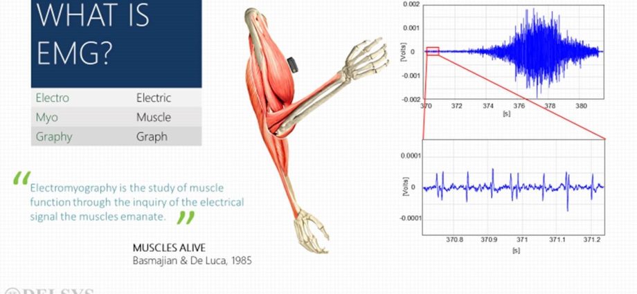 EMG research &#8211; indications, mileage, price. Does EMG hurt? WE EXPLAIN