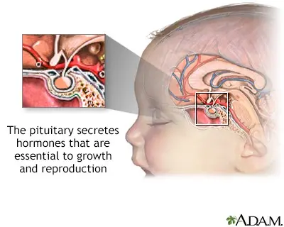 Empty saddle syndrome &#8211; symptoms and causes of the disease, research, treatment