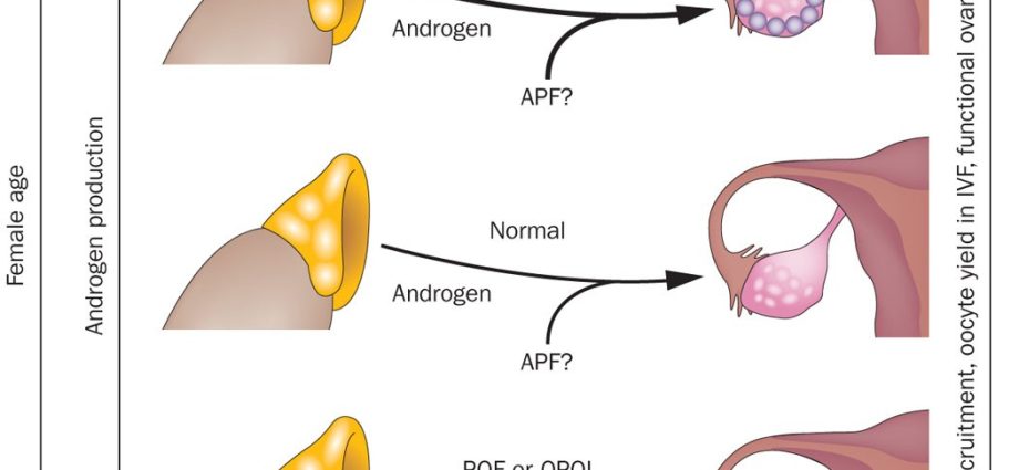 Endocrine dysfunction of the ovaries