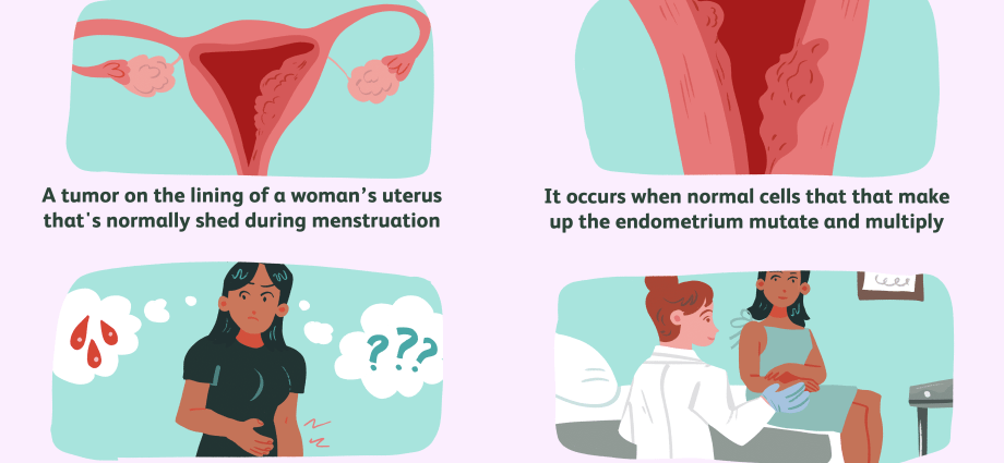 Endometrial cancer attacks overweight women. The symptoms are very characteristic