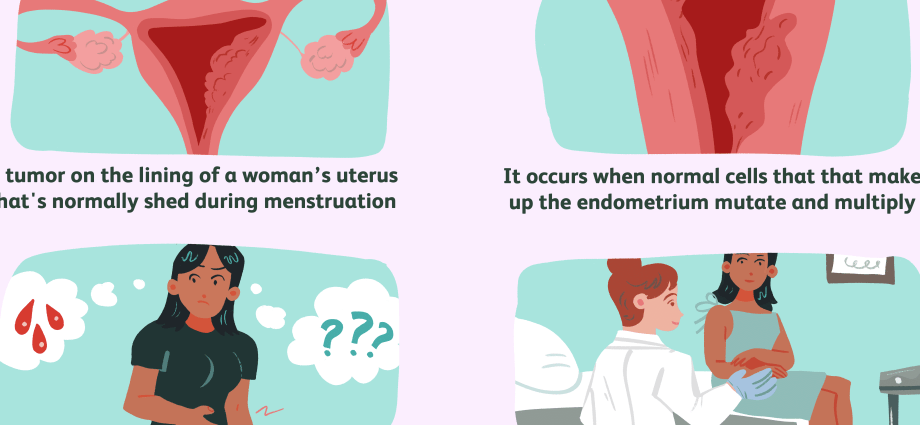 Endometrial cancer &#8211; symptoms, treatment. Endometrial cancer prevention