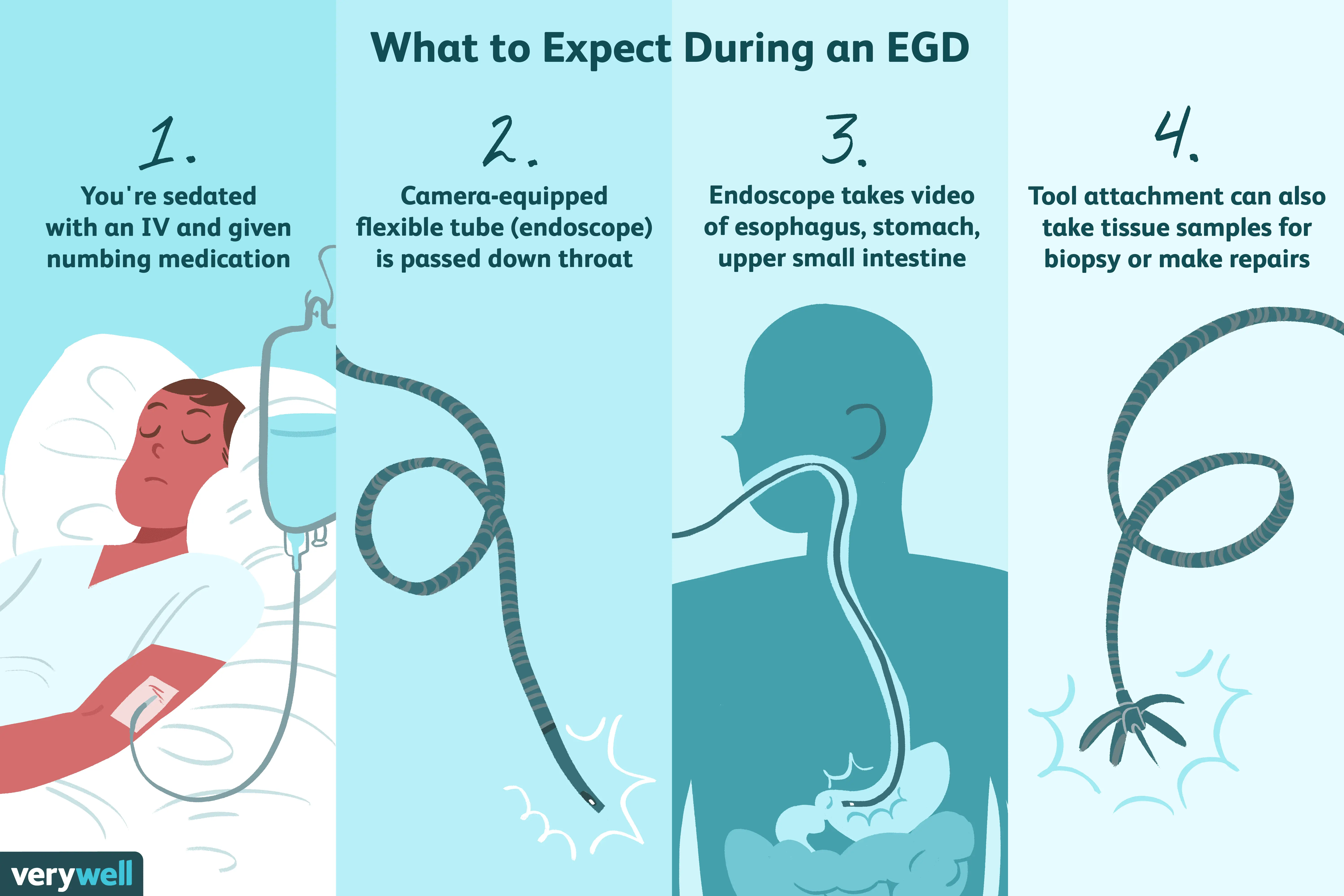 Endoscopic examination of the nose, esophagus and stomach. How to prepare for an endoscopic examination?