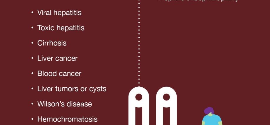 Enlarged liver &#8211; causes, diagnosis, diagnosis and treatment