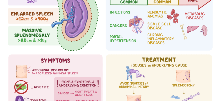 Enlarged spleen &#8211; symptoms, causes and treatment.