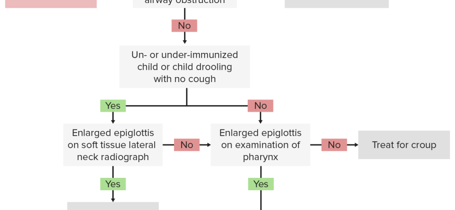 Epiglottitis &#8211; course and treatment