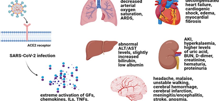 Epilepsy and stroke after COVID-19. &#8220;One of the destructive features of this virus&#8221;