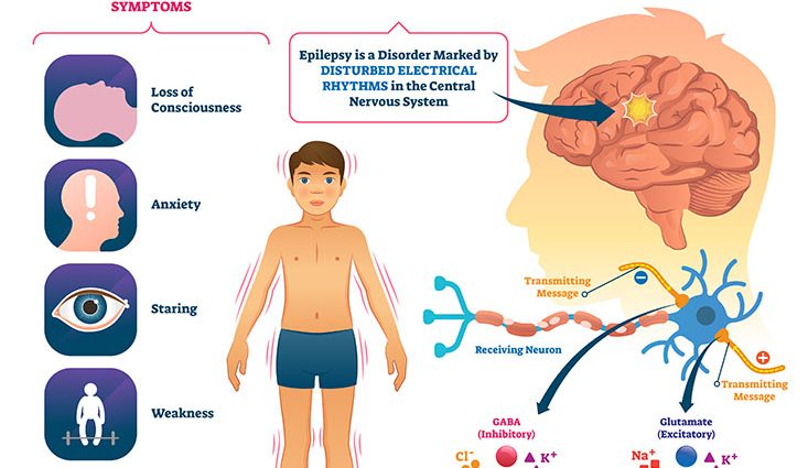 Epilepsy is the most common neurological disease in children