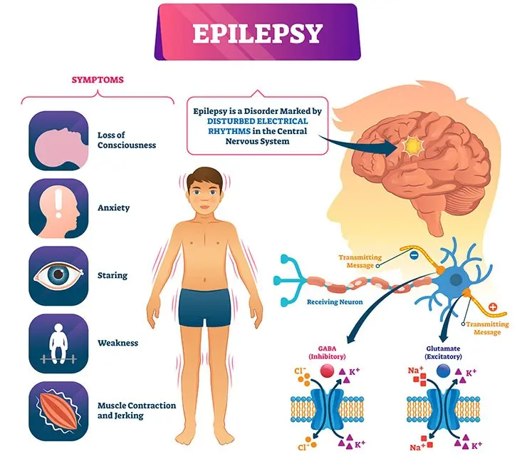 Epilepsy is the most common neurological disease in children