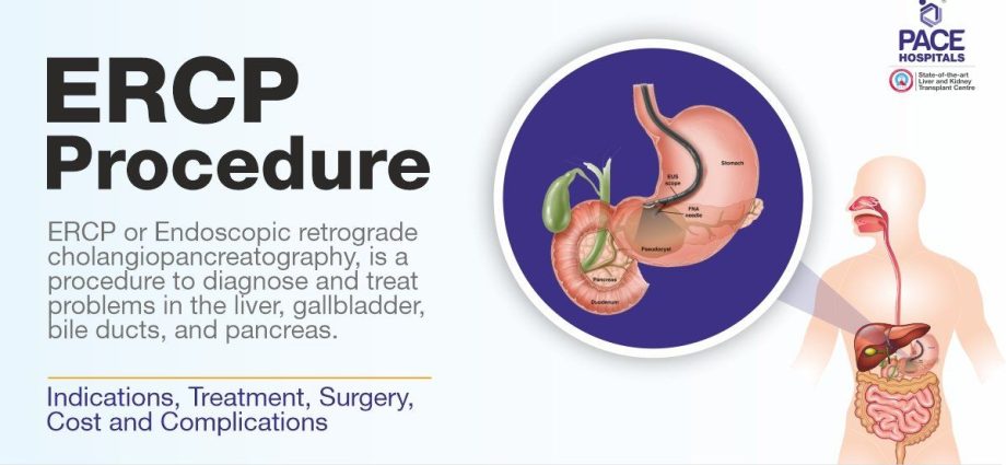 ERCP &#8211; what it is and when it is performed. Course, preparation and possible complications