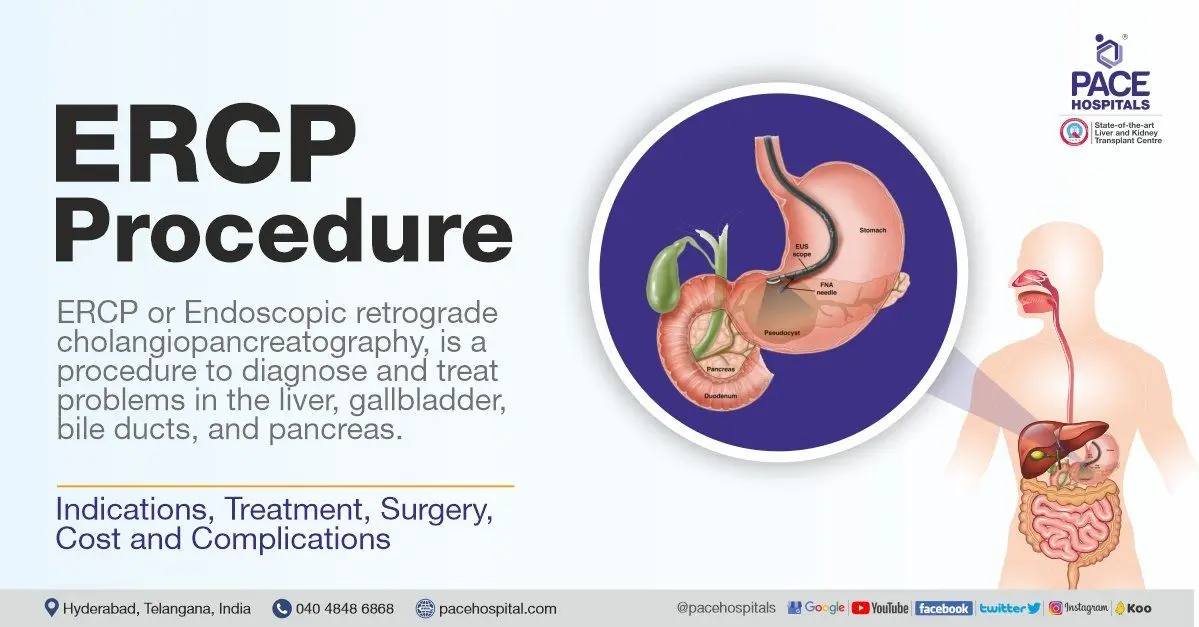 ERCP &#8211; what it is and when it is performed. Course, preparation and possible complications