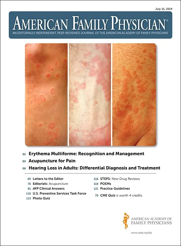 Erythema &#8211; types, symptoms, photos, treatment