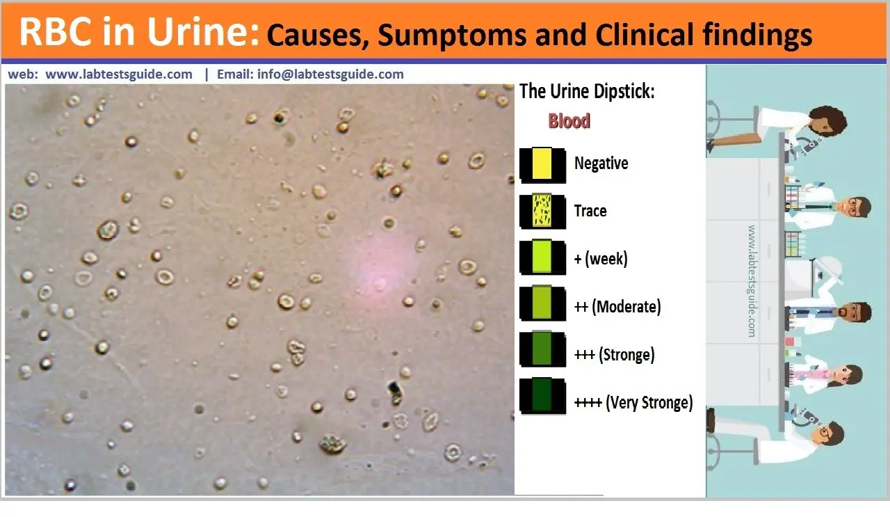 Erythrocytes in urine &#8211; is there anything to be concerned about?