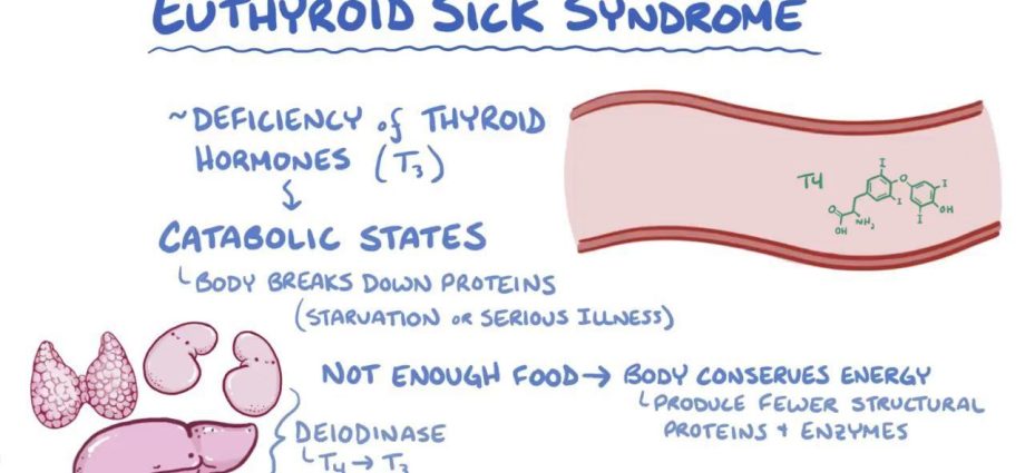 Euthyroidism &#8211; description, diseases of the thyroid gland with euthyroidism