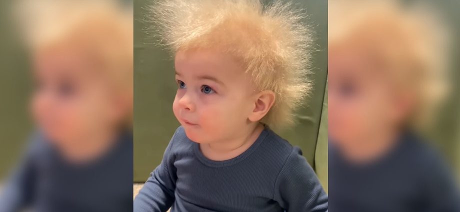 Everything is sticking up and glowing on the child&#8217;s head? It could be &#8220;hairless hair syndrome&#8221;