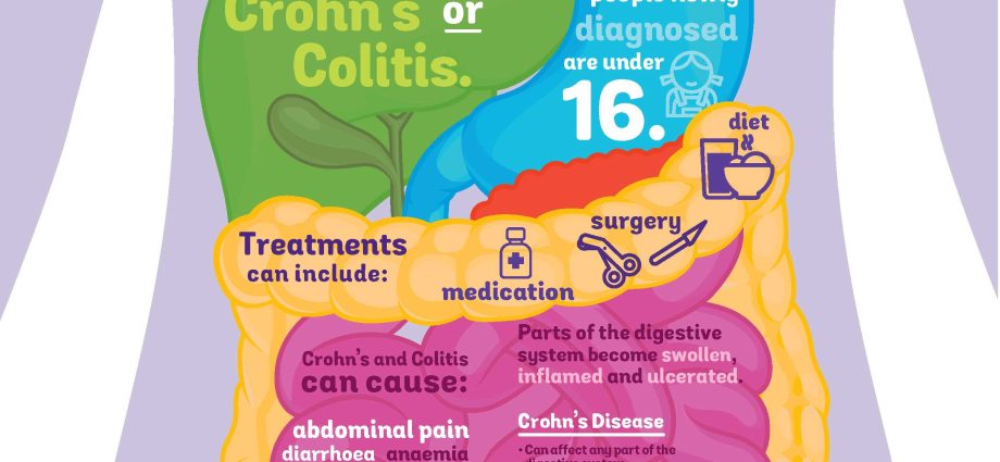 Everything you need to know about bowel disease