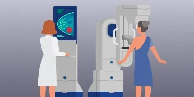 Everything you need to know about mammography