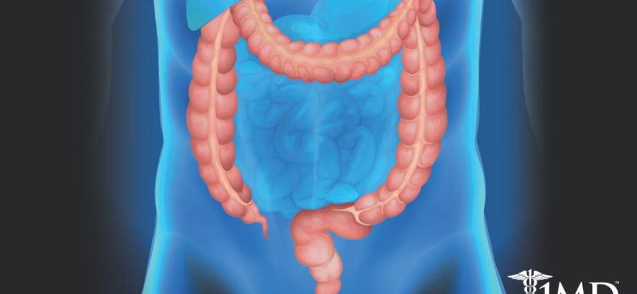 Everything you need to know about the large intestine and you are ashamed to ask