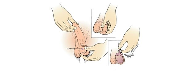 Examine your testicles in front of the mirror