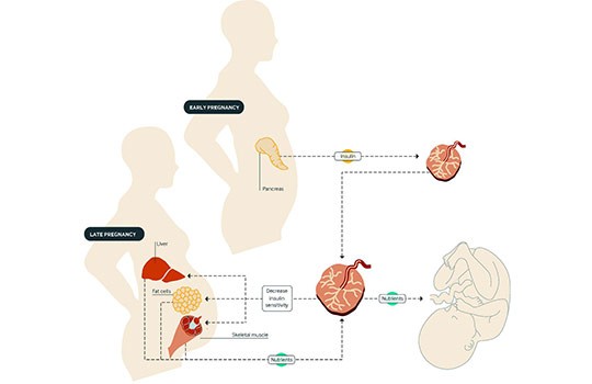 Excessive weight gain in pregnancy poses a risk of obesity in the offspring