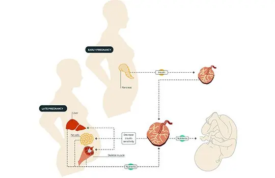 Excessive weight gain in pregnancy poses a risk of obesity in the offspring