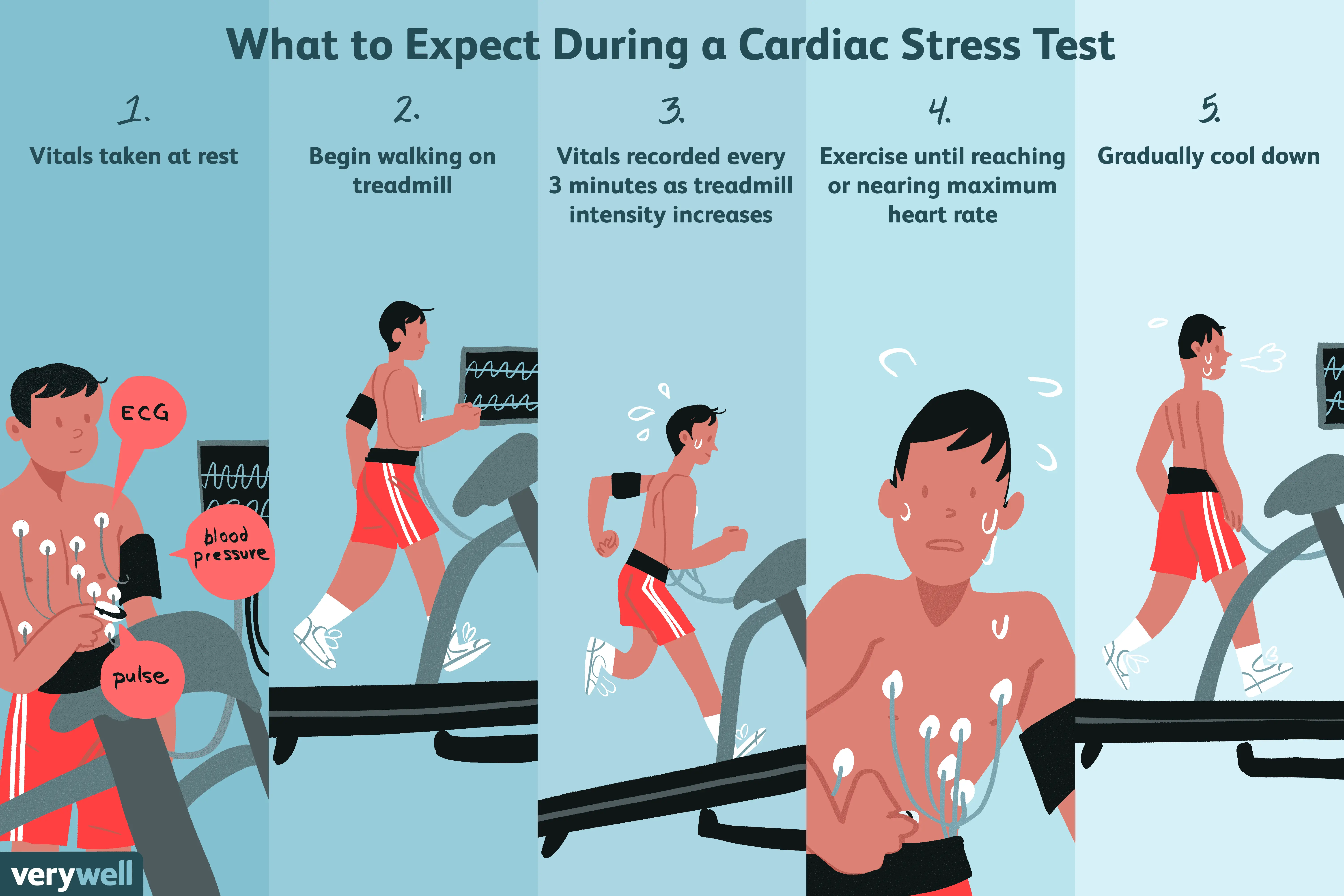 Exercise test &#8211; what is it and when to use it