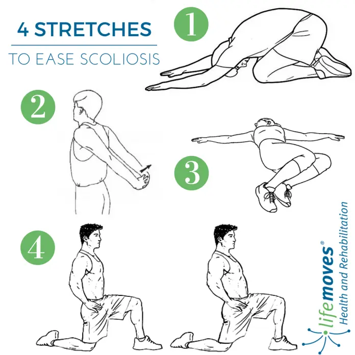 Exercises for a child with scoliosis