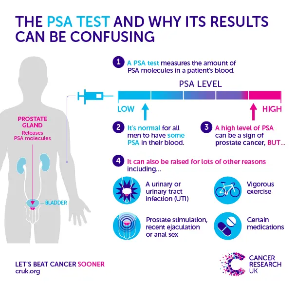 Experts: PSA tests for prostate cancer do more harm than good