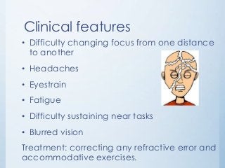 Eye accommodation &#8211; causes, types, treatment. Exercises for eye accommodation