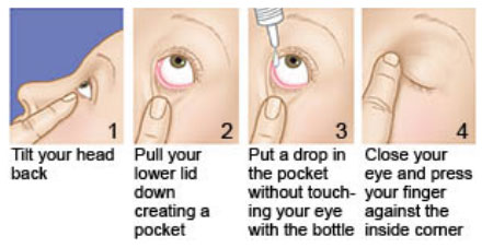 Eye drops &#8211; types, side effects. How to properly instill your eyes?