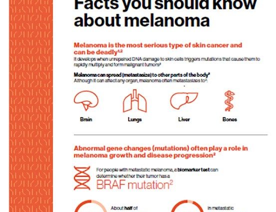 Facts and myths about melanoma