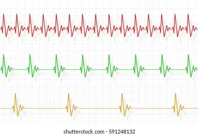 Fast or slow heart rate