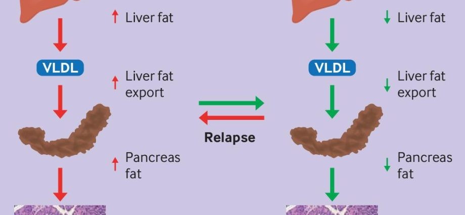 Fat cells are the main culprits of type 2 diabetes