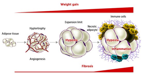 Fat tissue &#8211; underflow, excess and burning. How To Get Rid Of Fat Tissue?