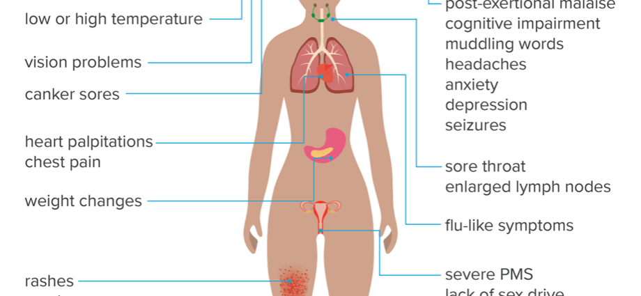 Fatigue and leg pain