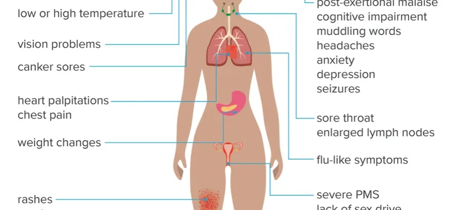 Fatigue and leg pain