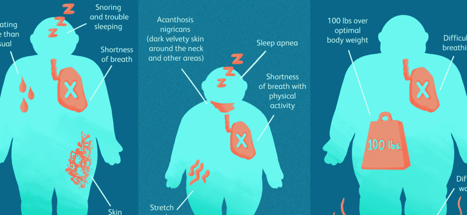 Fatter &#8211; causes, symptoms, treatment