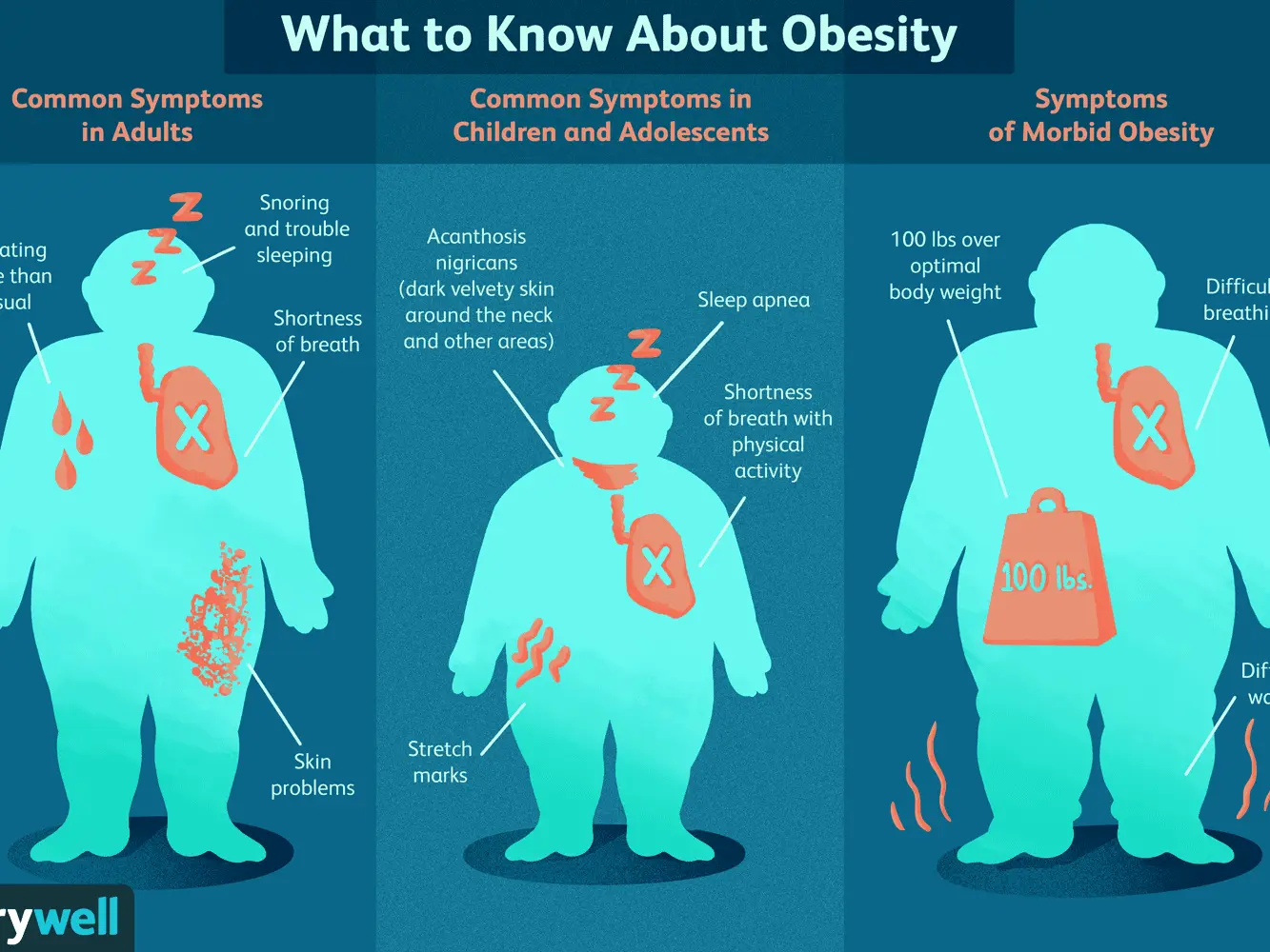 Fatter &#8211; causes, symptoms, treatment. Fatter in adults and children