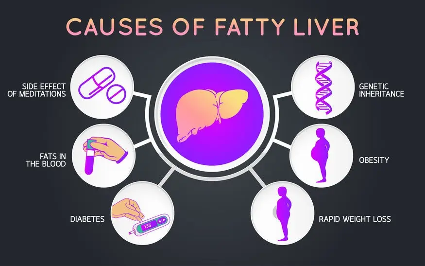 Fatty liver promotes diabetes