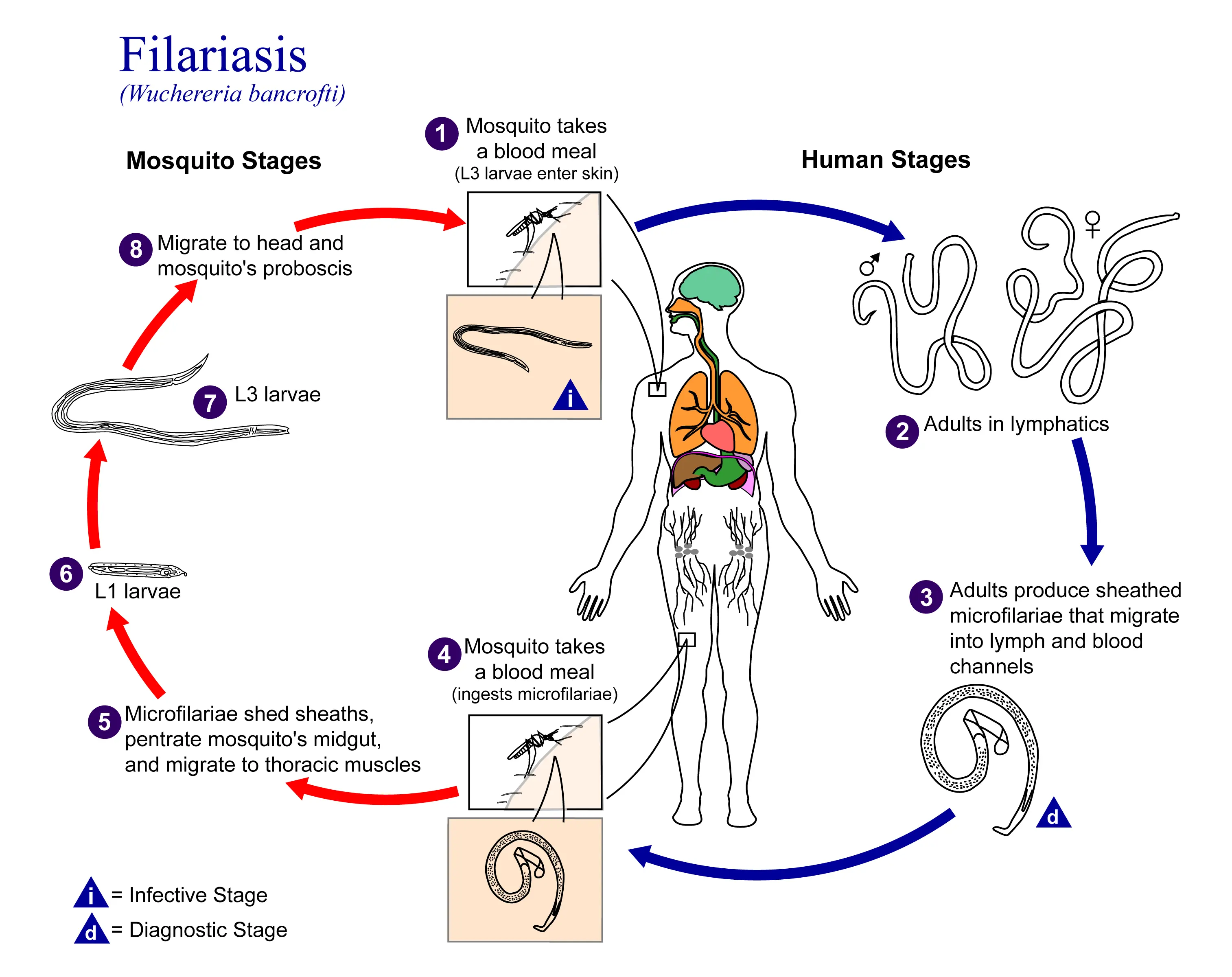 Filariasis &#8211; Symptoms and Treatment