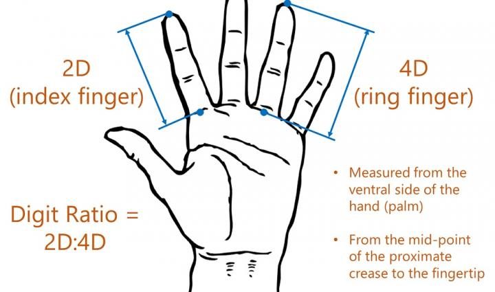 Finger Length and Neurological Disease