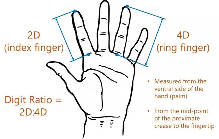 Finger Length and Neurological Disease